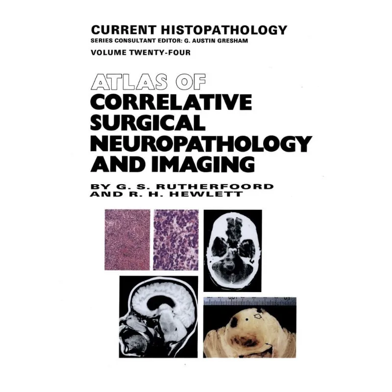 Atlas of Correlative Surgical Neuropathology and Imaging
