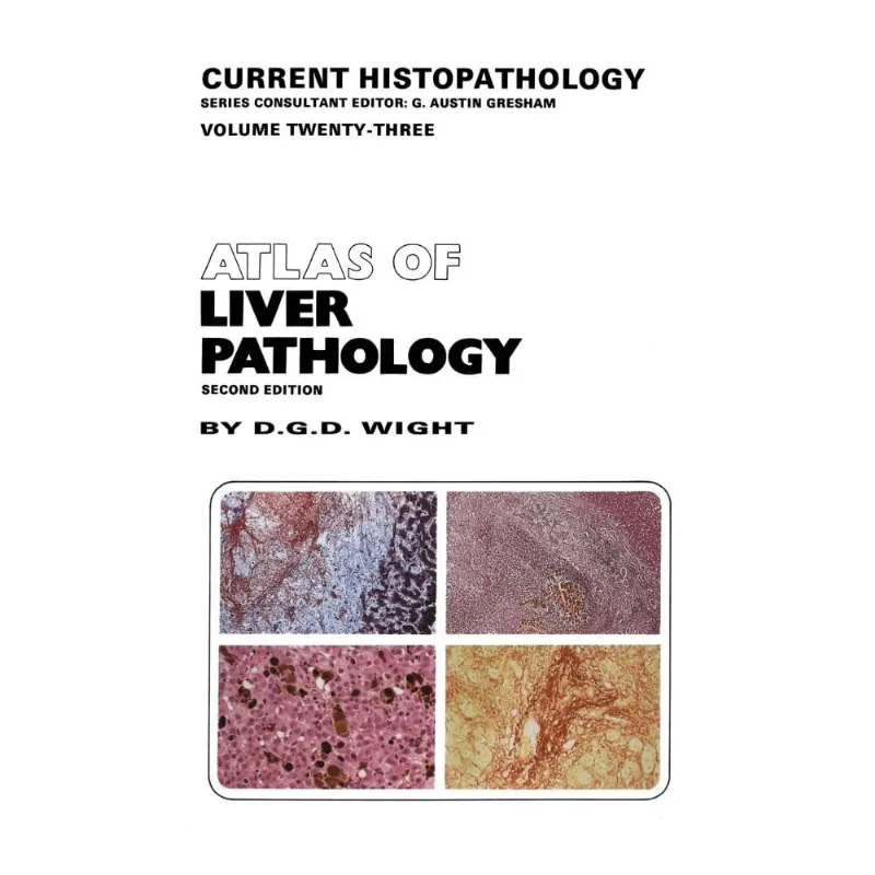 Atlas of Liver Pathology