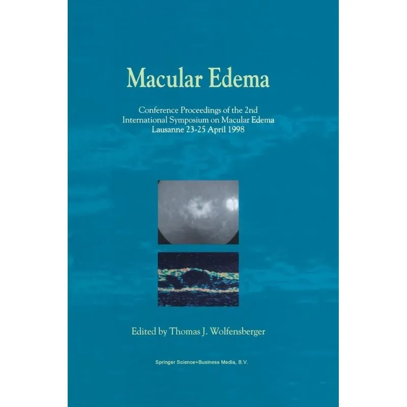 Macular Edema