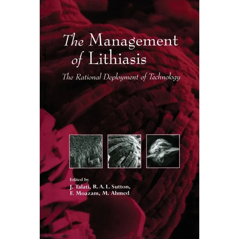 The Management of Lithiasis