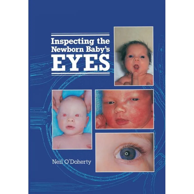 Inspecting the Newborn Babys Eyes