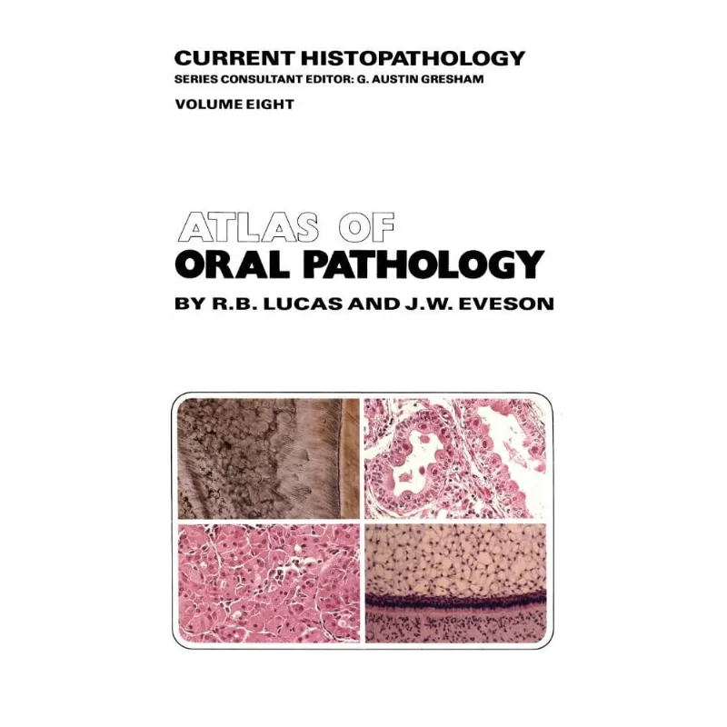 Atlas of Oral Pathology