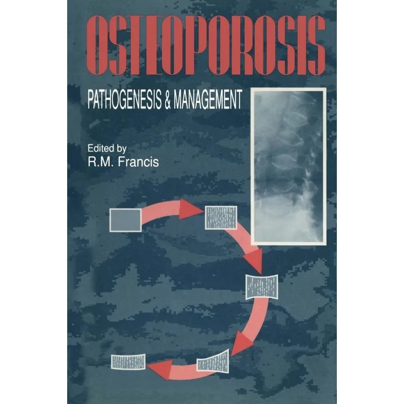 Osteoporosis