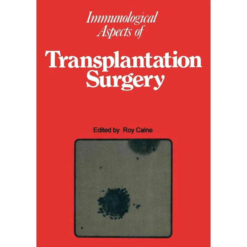 Immunological Aspects of Transplantation Surgery