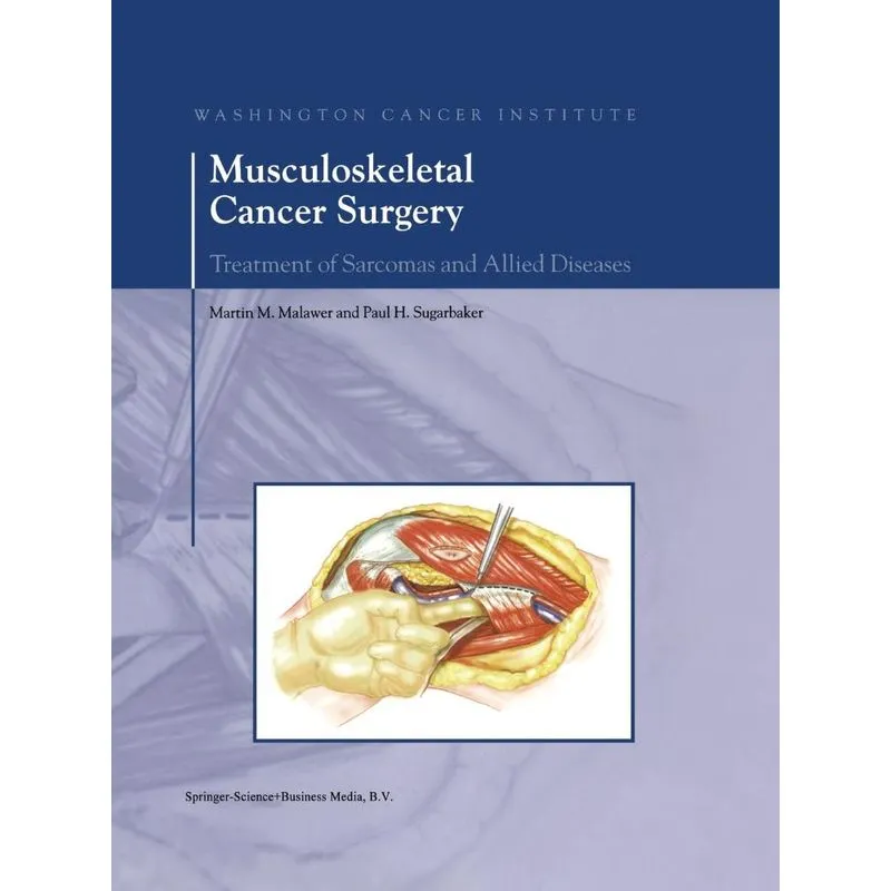 Musculoskeletal Cancer Surgery