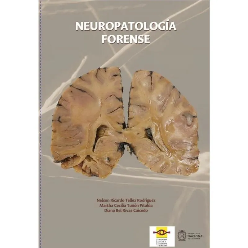 Neuropatología forense-Espanhol