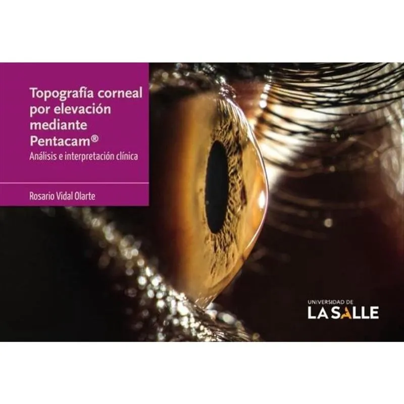 Topografía corneal por elevación mediante Pentacam - Espanhol