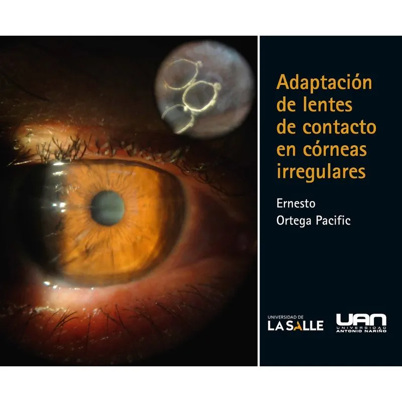 Adaptación de lentes de contacto en córneas irregulares