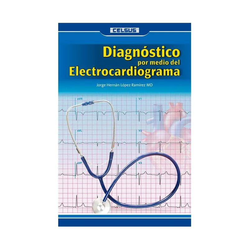 Diagnóstico por medio del electrocardiograma