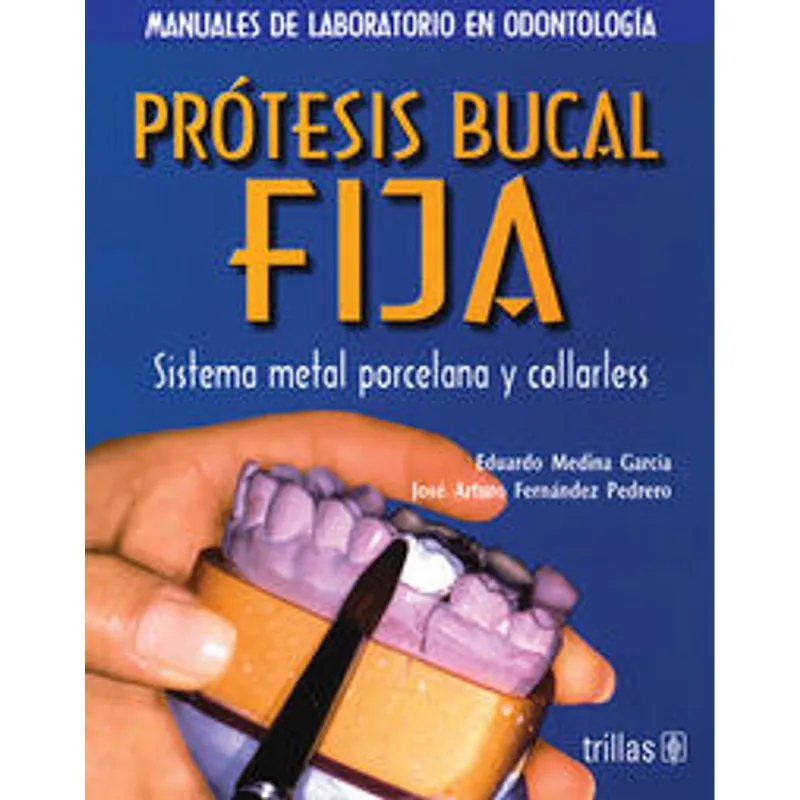 Protesis bucal fija Prótesis bucal fija