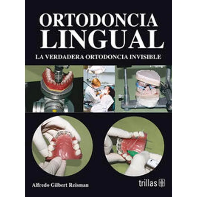 Ortodoncia lingual
