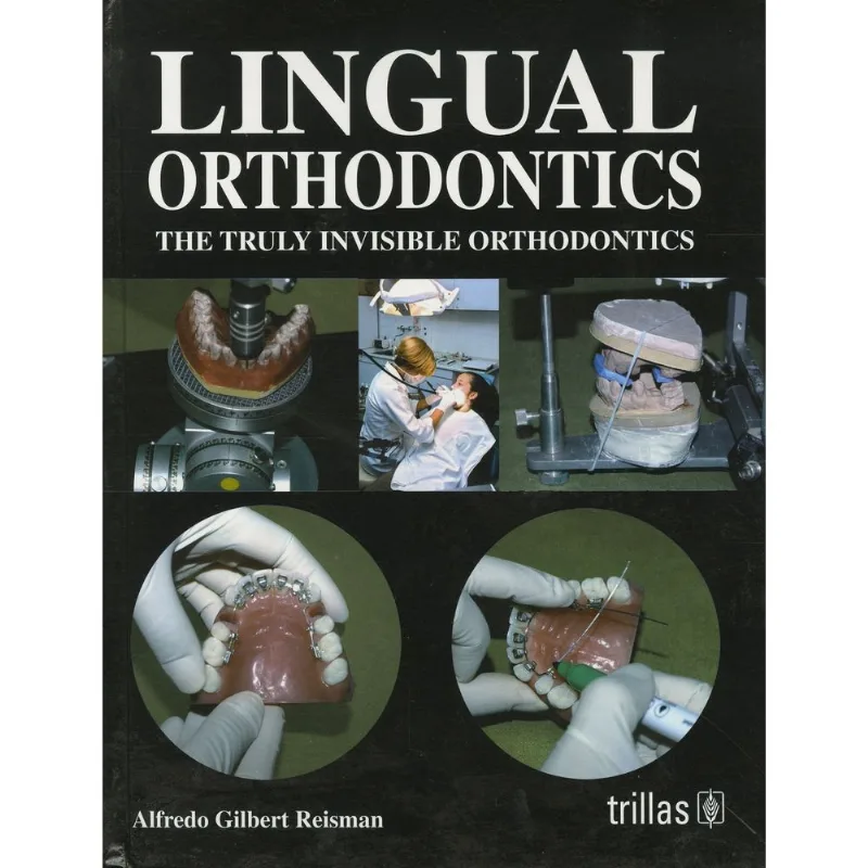 Lingual orthodontics