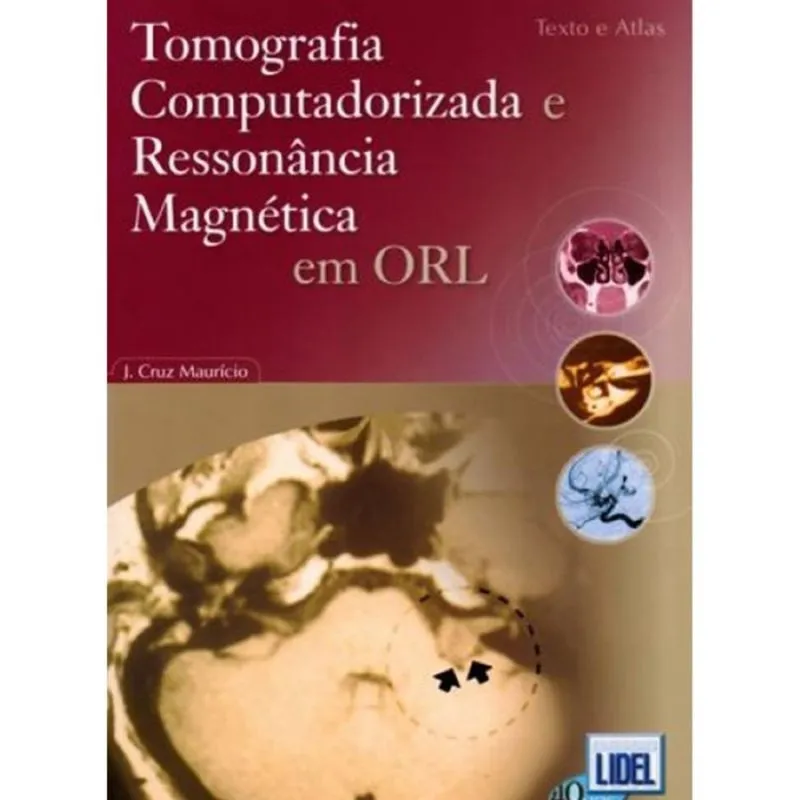 Tomografia computadorizada e ressonância magnética em orl
