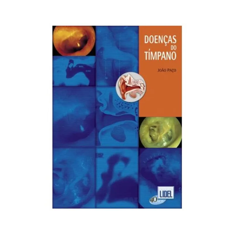 DOENÇAS DO TÍMPANO