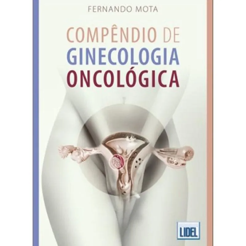 Compêndio de ginecologia oncológica