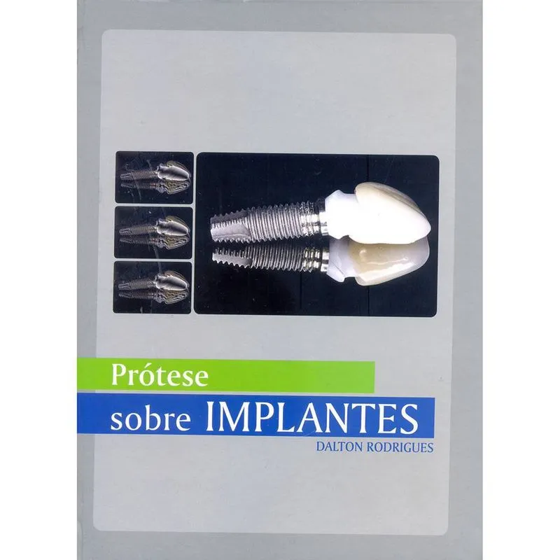Protese sobre implantes 01