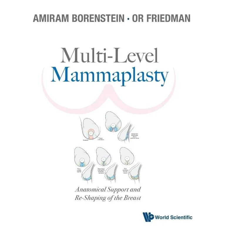 Multi-Level Mammaplasty