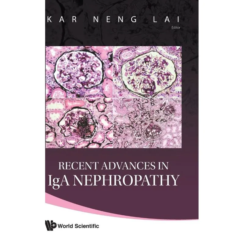 RECENT ADVANCES IN IGA NEPHROPATHY