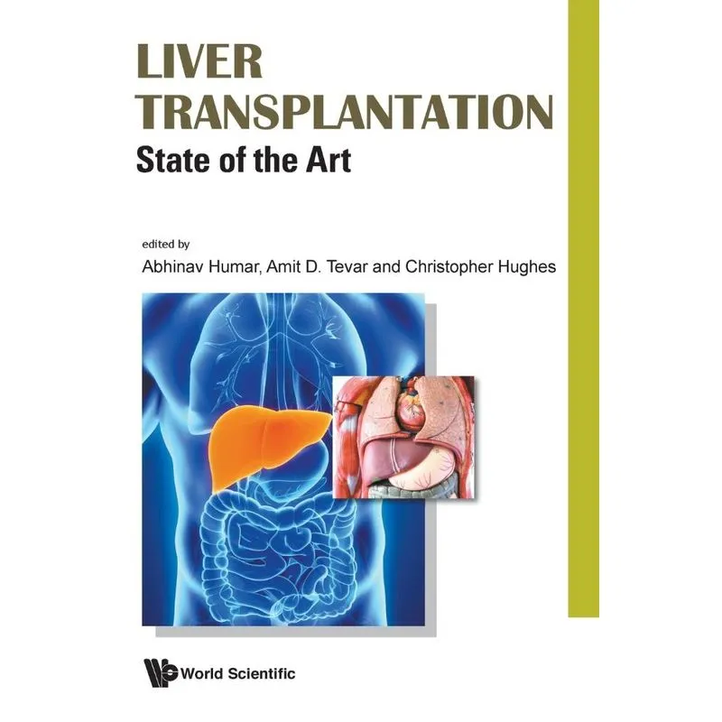 Liver Transplantation