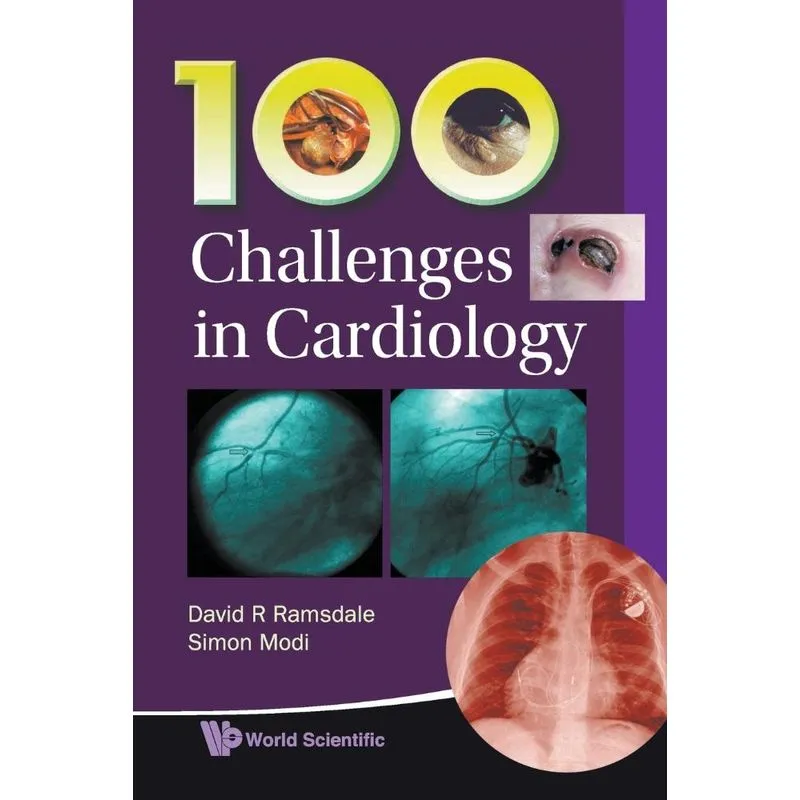 100 Challenges in Cardiology