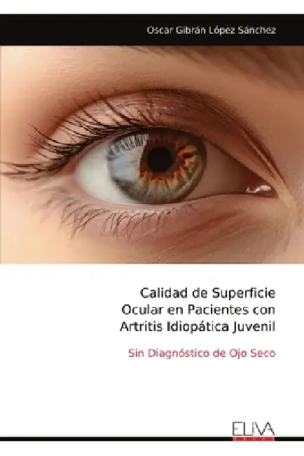 Calidad de Superficie Ocular en Pacientes con Artritis Idiopática Juvenil: Sin Diagnóstico de Ojo Seco Paperback